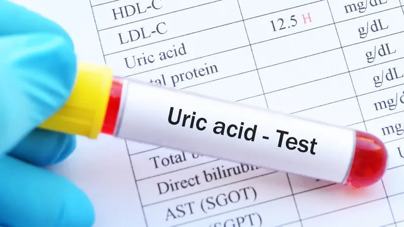 Uric Acid and Erectile Dysfunction KnoWEwell