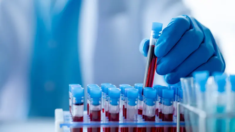 Lab assistant examines a patient's blood sample