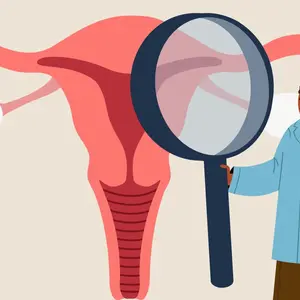 Vector illustration of a doctor using a large magnifying glass to examine an illustrated cervix for HPV Vector illustration of a doctor using a large magnifying glass to examine an illustrated cervix for HPV