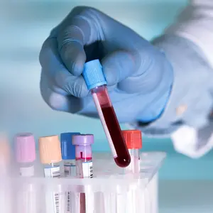 Lab technician holding blood tube sample for study Lab technician holding blood tube sample for study